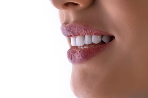 Veneers service
