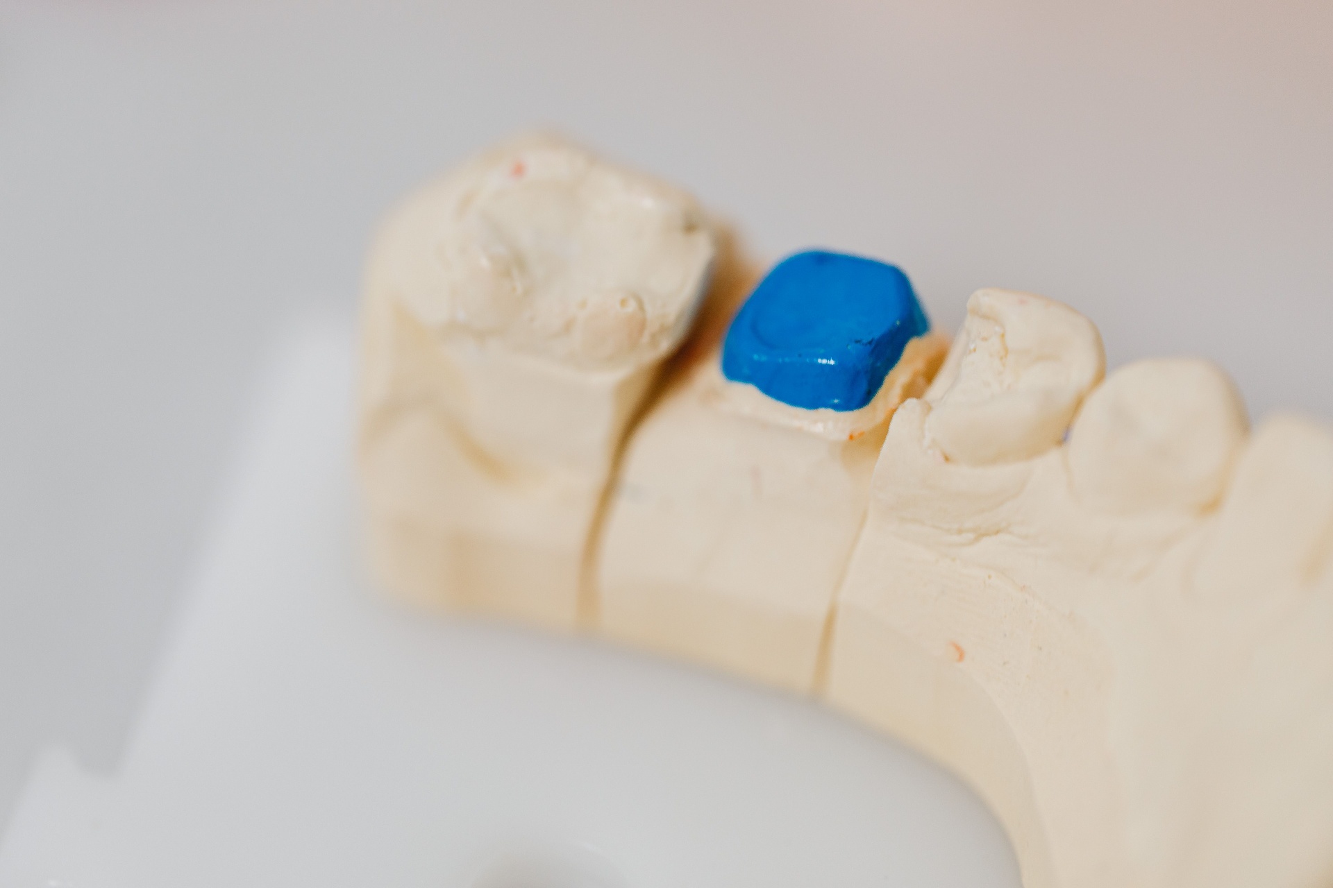 Dental implants
