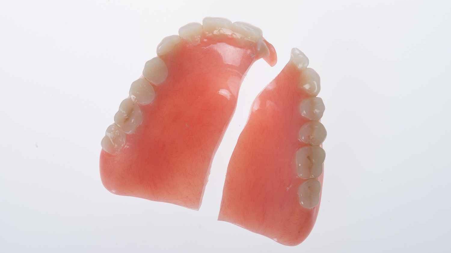 Why does a repaired denture fracture again?
