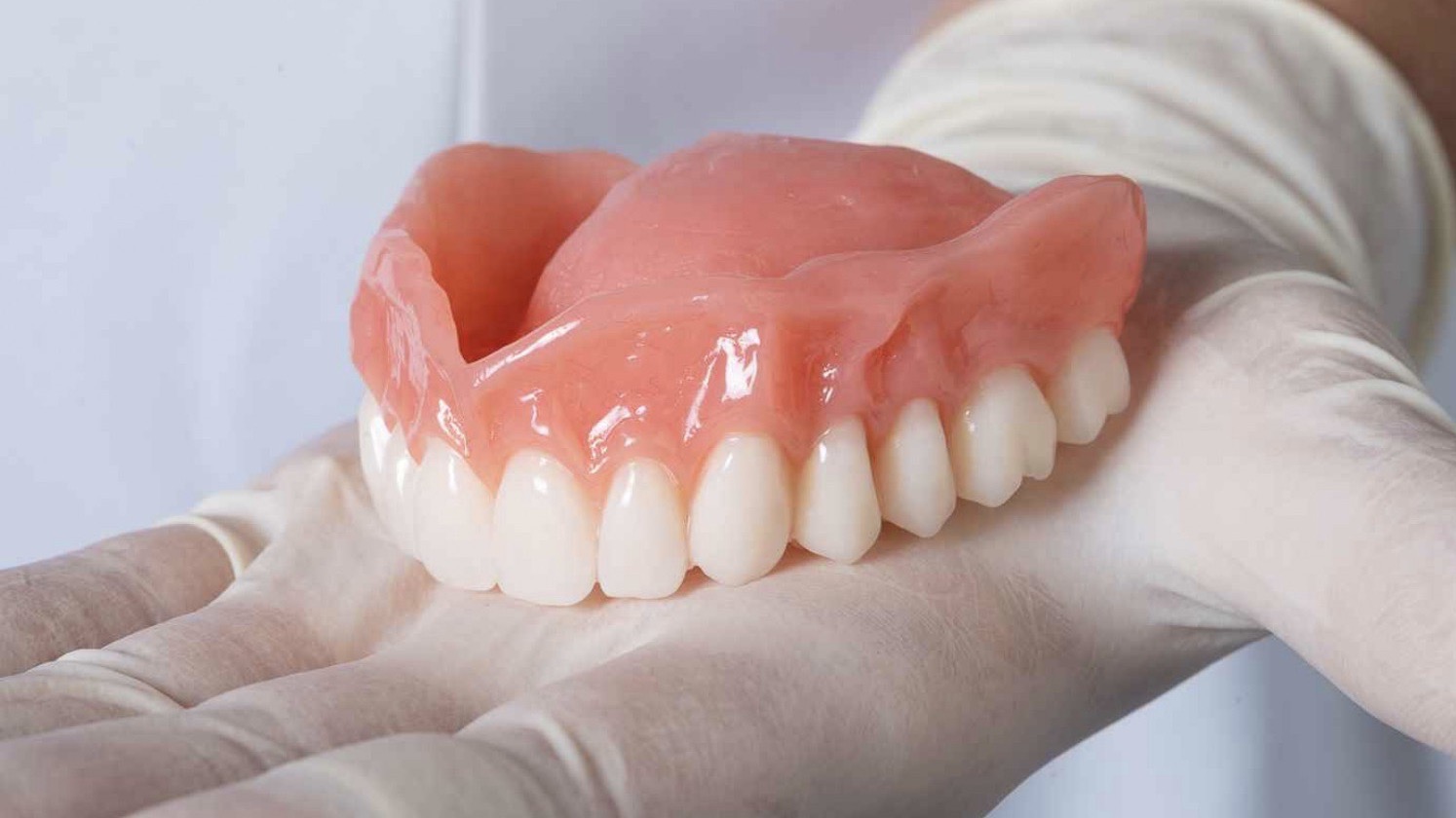 How long do immediate dentures last?